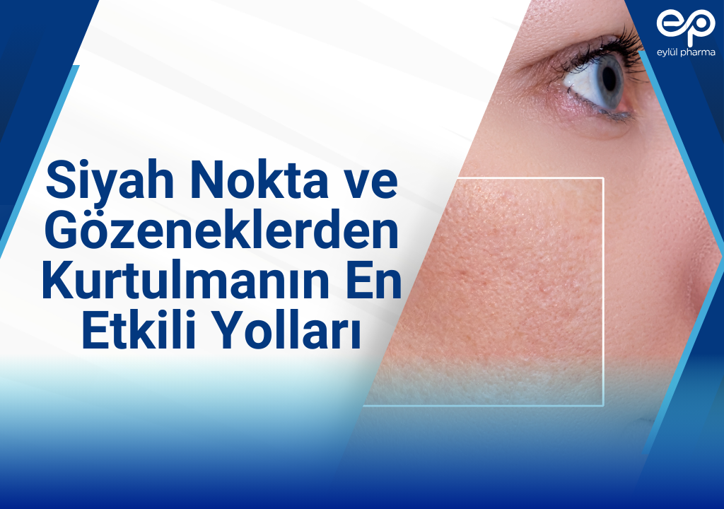 siyah nokta ve gözenek temizleme