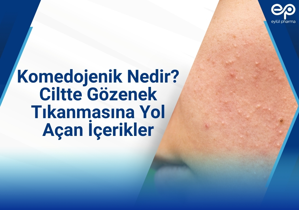 komedon, komedojenik